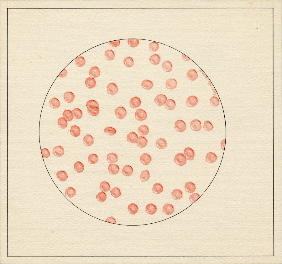 Pastel drawing of normal Hemoglobin cells