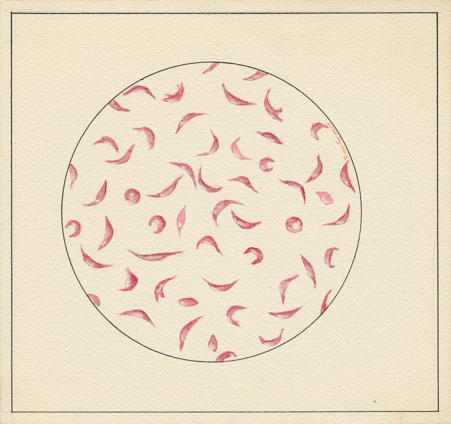 Pastel drawing of sickled Hemoglobin cells