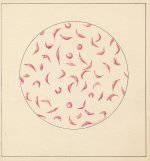 Zeichnung eines abnormalen Roten Blutkörperchens von Roger Hayward, ca. 1964.